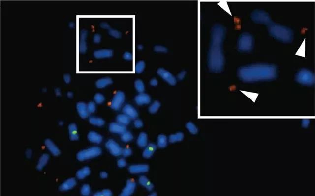 普纳替尼,染色体外DNA能促进癌细胞疾速生长？