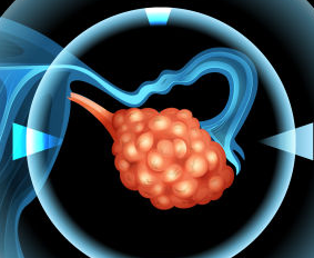 九大治疗卵巢癌的中医药物是什么？