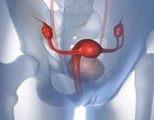 中药是怎么治疗晚期卵巢癌的？